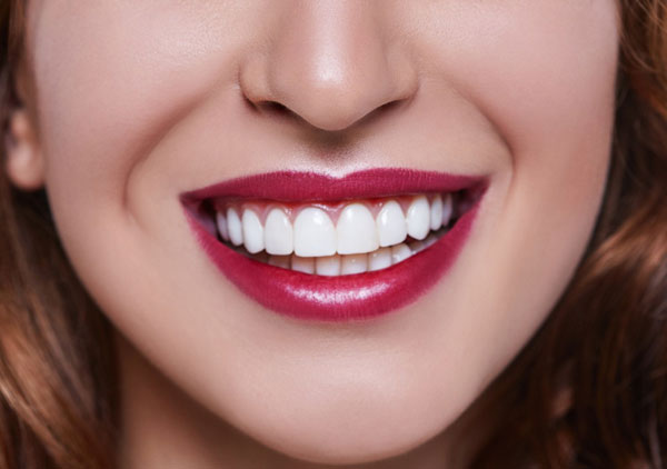 Виниры для зубов: лучший способ быстро вернуть красоту улыбки