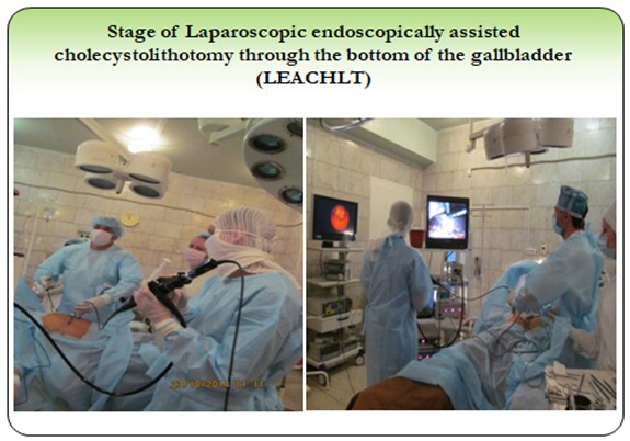 Stage of Laparoscopic assisted