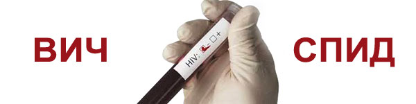 Как самому разобраться в тестировании на ВИЧ
