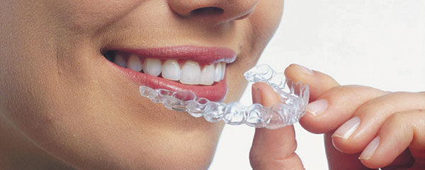 Искривление зубов – это серьезный стоматологический дефект, который приносит не только эстетические неудобства.