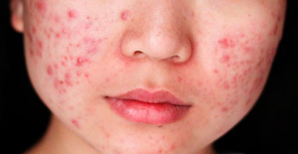 Поширені дерматологічні проблеми у Дніпрі