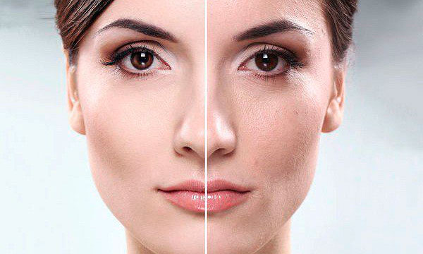 Мезотерапія Мезотерапія