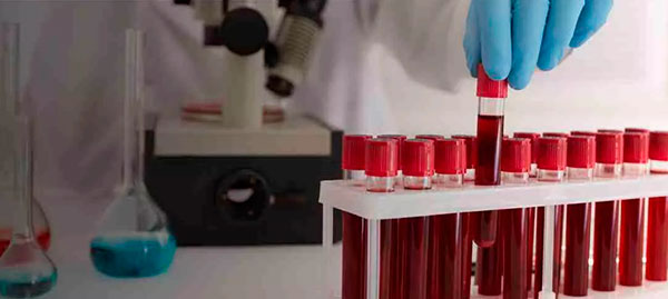 Про що свідчить загальний аналіз крові: як не панікувати через цифри Про що свідчить загальний аналіз крові: як не панікувати через цифри