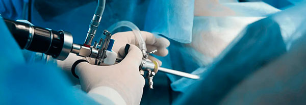 Сучасна гістероскопія