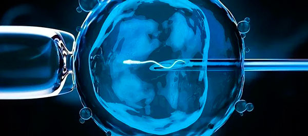 У Medical Plaza пояснили, хто може претендувати на безкоштовне ЕКЗ за програмою НСЗУ